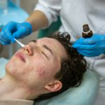 Treatment of acne in adolescents. Facial peeling to fight acne on the face